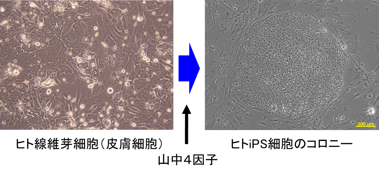 ヒト線維細胞とヒトiPS細胞のコロニーの画像