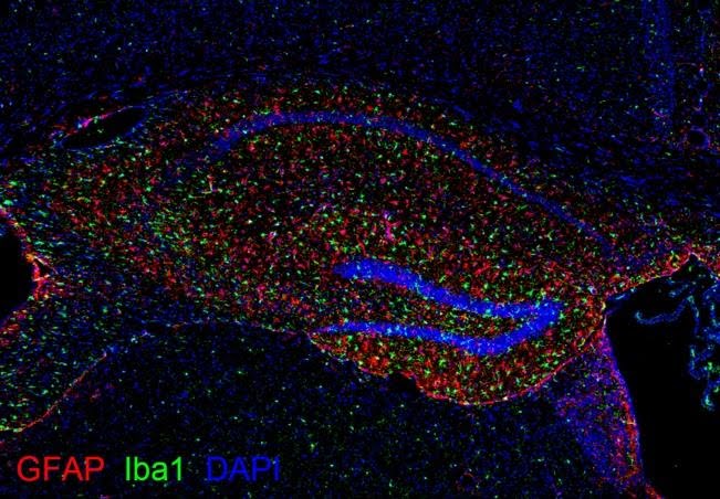 Fig. 2. Inflammation in the hippocampus of a mouse model of neurodegenerative disease