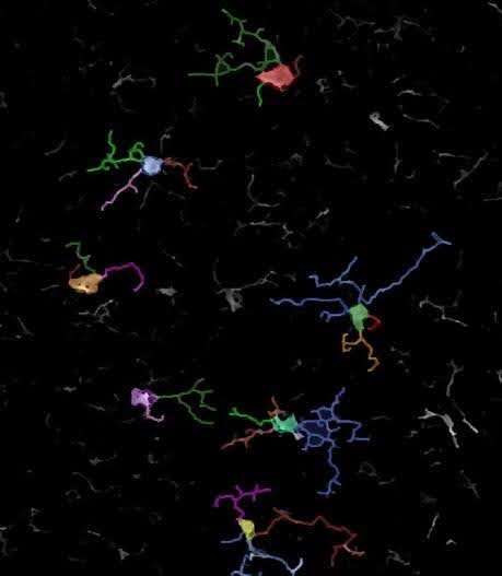 Fig. 3. Morphology of mouse hippocampal microglia automatically recognized by AI